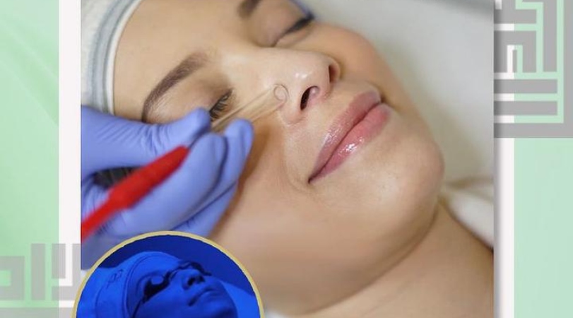 3 Treatment Unggulan Ala Tities Sapoetra 3 Treatment Unggulan Ala Tities Sapoetra